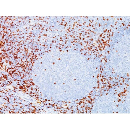 Immunohistochemistry - Anti-CD8A Antibody [C8/144B] (A250558) - Antibodies.com