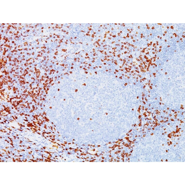 Immunohistochemistry - Anti-CD8A Antibody [C8/144B] (A250558) - Antibodies.com