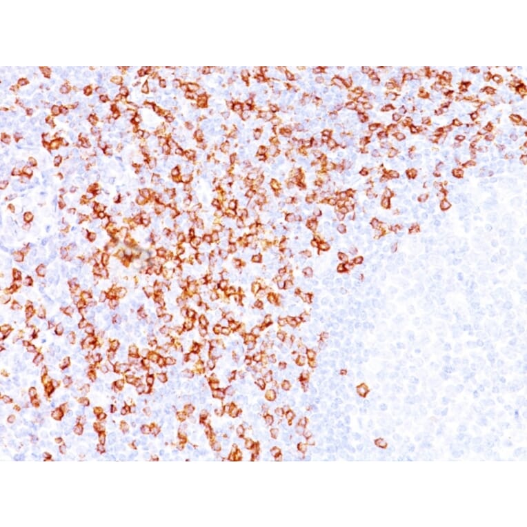 Immunohistochemistry - Anti-CD8A Antibody [C8/144B] (A250557) - Antibodies.com