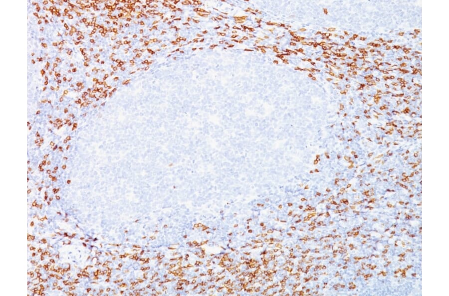 Immunohistochemistry - Anti-CD8A Antibody [C8/468 + C8/144B] (A250558) - Antibodies.com