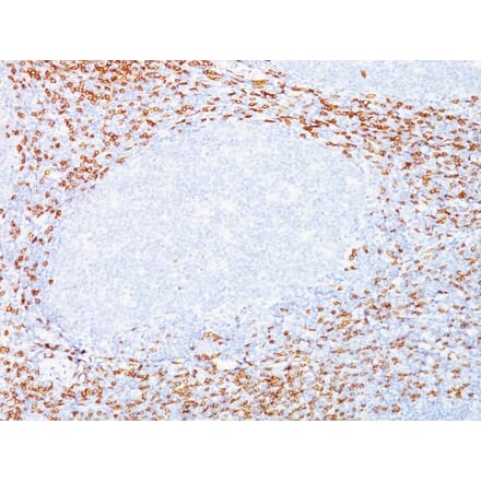 Immunohistochemistry - Anti-CD8A Antibody [C8/468 + C8/144B] (A250558) - Antibodies.com