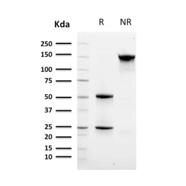SDS-PAGE - Anti-CD8A Antibody [C8/468 + C8/144B] (A250559) - Antibodies.com