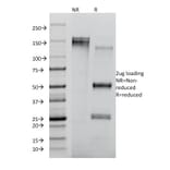 SDS-PAGE - Anti-CD8A Antibody [RIV11] (A250562) - Antibodies.com