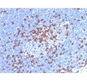 Immunohistochemistry - Anti-CD8A Antibody [CD8/4391R] (A250563) - Antibodies.com