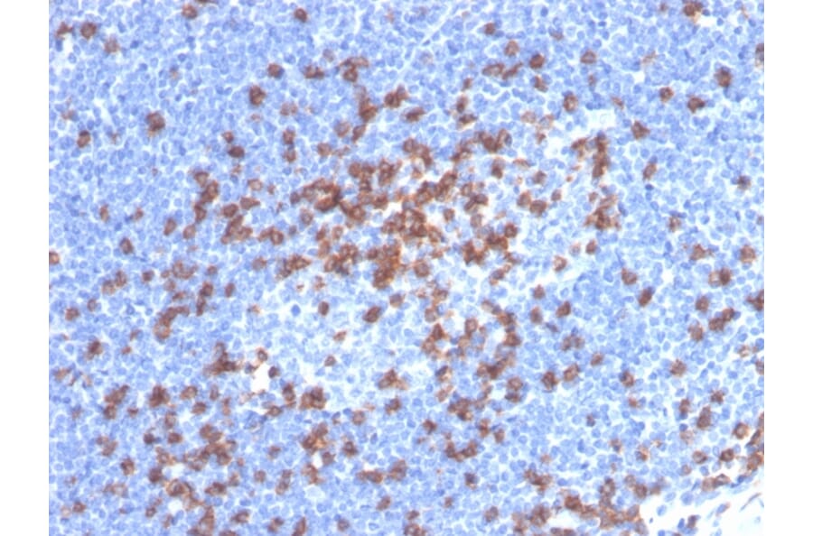 Immunohistochemistry - Anti-CD8A Antibody [CD8/4391R] (A250563) - Antibodies.com