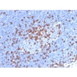Immunohistochemistry - Anti-CD8A Antibody [CD8/4391R] (A250563) - Antibodies.com