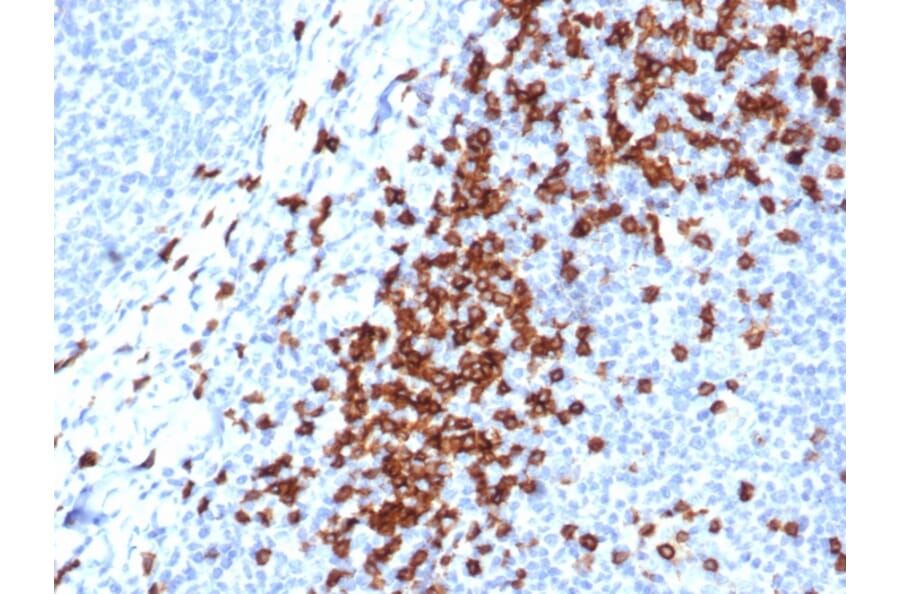 Immunohistochemistry - Anti-CD8A Antibody [CD8/4391R] (A250563) - Antibodies.com