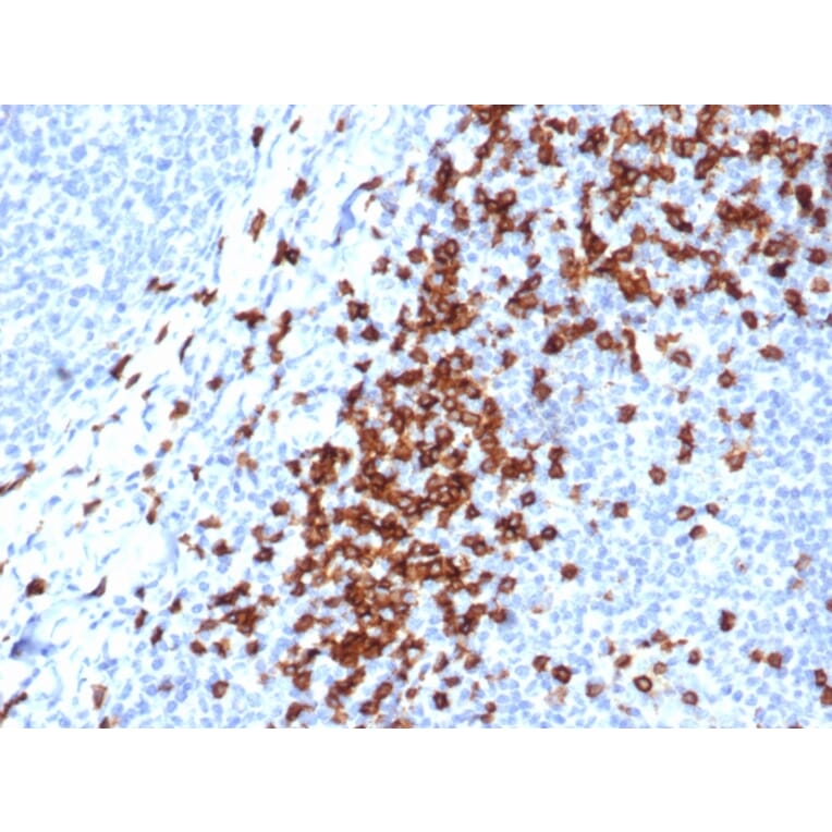 Immunohistochemistry - Anti-CD8A Antibody [CD8/4391R] (A250563) - Antibodies.com