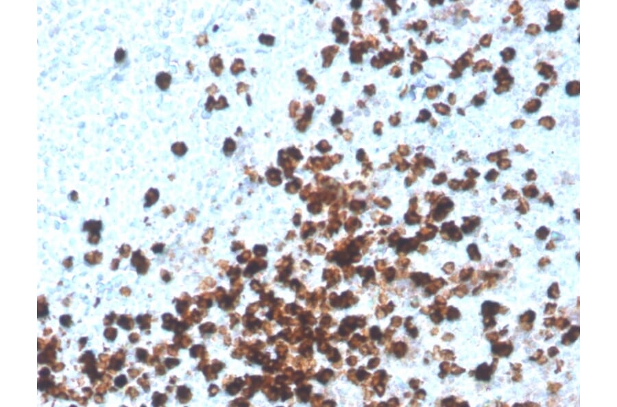 Immunohistochemistry - Anti-CD8A Antibody [CD8/4391R] (A250563) - Antibodies.com