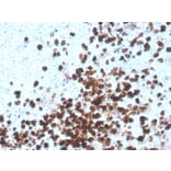 Immunohistochemistry - Anti-CD8A Antibody [CD8/4391R] (A250563) - Antibodies.com