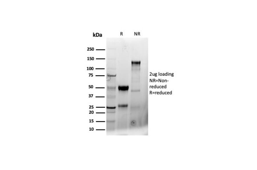 SDS-PAGE - Anti-CD8A Antibody [CD8/4391R] (A250563) - Antibodies.com