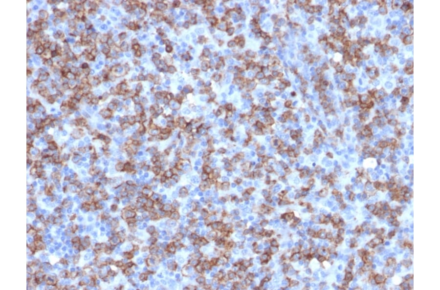 Immunohistochemistry - Anti-CD8A Antibody [C8/1779R] (A250563) - Antibodies.com