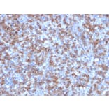 Immunohistochemistry - Anti-CD8A Antibody [C8/1779R] (A250563) - Antibodies.com