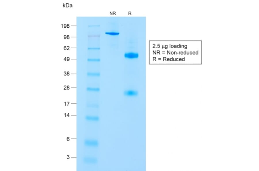 SDS-PAGE - Anti-CD8A Antibody [C8/1779R] (A250565) - Antibodies.com