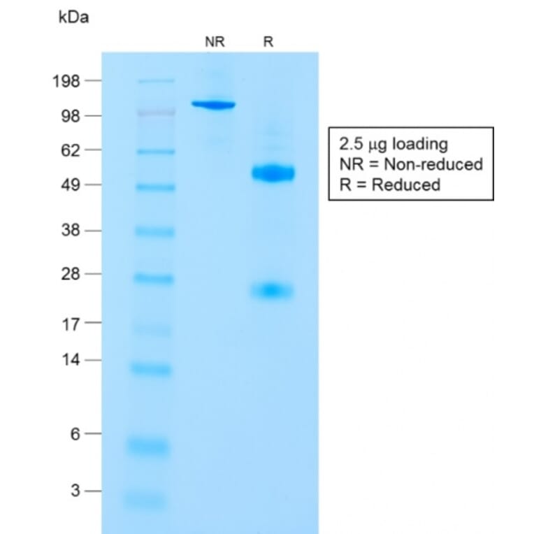 SDS-PAGE - Anti-CD8A Antibody [C8/1779R] (A250565) - Antibodies.com