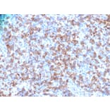 Immunohistochemistry - Anti-CD8A Antibody (A250565) - Antibodies.com