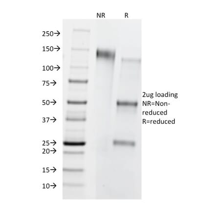 SDS-PAGE - Anti-CD8B Antibody [BU88] (A250566) - Antibodies.com