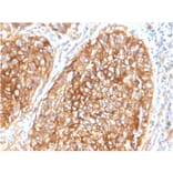Immunohistochemistry - Anti-CD9 Antibody [CD9/1619] (A250570) - Antibodies.com