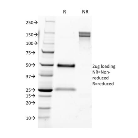 SDS-PAGE - Anti-CD9 Antibody [CD9/1631] (A250572) - Antibodies.com