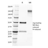 SDS-PAGE - Anti-CD9 Antibody [CD9/1631] (A250572) - Antibodies.com