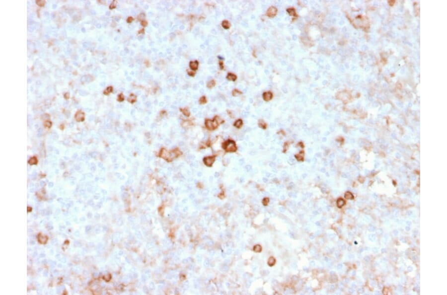 Immunohistochemistry - Anti-CD14 Antibody [rLPSR/2408] (A250573) - Antibodies.com
