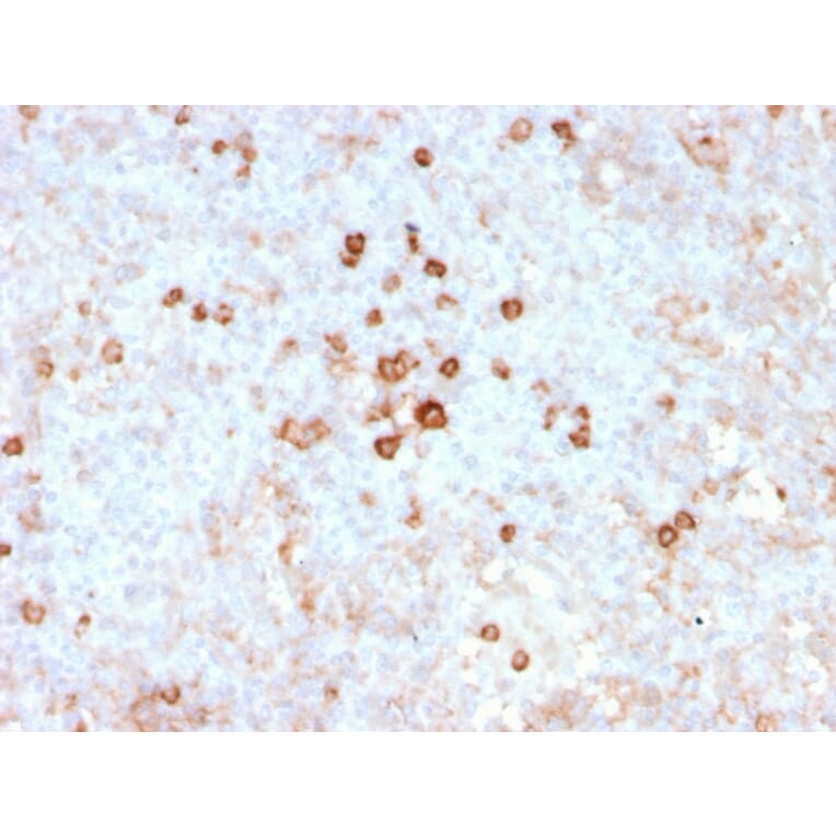 Immunohistochemistry - Anti-CD14 Antibody [rLPSR/2408] (A250573) - Antibodies.com