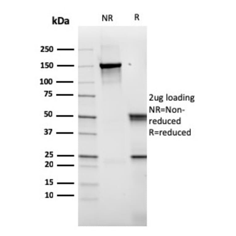 SDS-PAGE - Anti-CD14 Antibody [rLPSR/2408] (A250574) - Antibodies.com