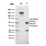 SDS-PAGE - Anti-CD14 Antibody [rLPSR/2408] (A250574) - Antibodies.com