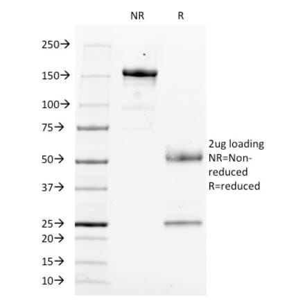 SDS-PAGE - Anti-CD14 Antibody [LPSR/553] (A250575) - Antibodies.com
