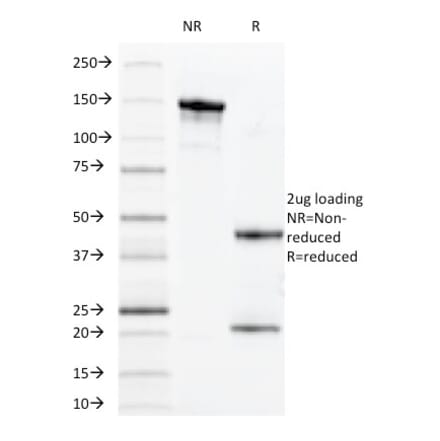 SDS-PAGE - Anti-CD14 Antibody [MDA/929] (A250576) - Antibodies.com