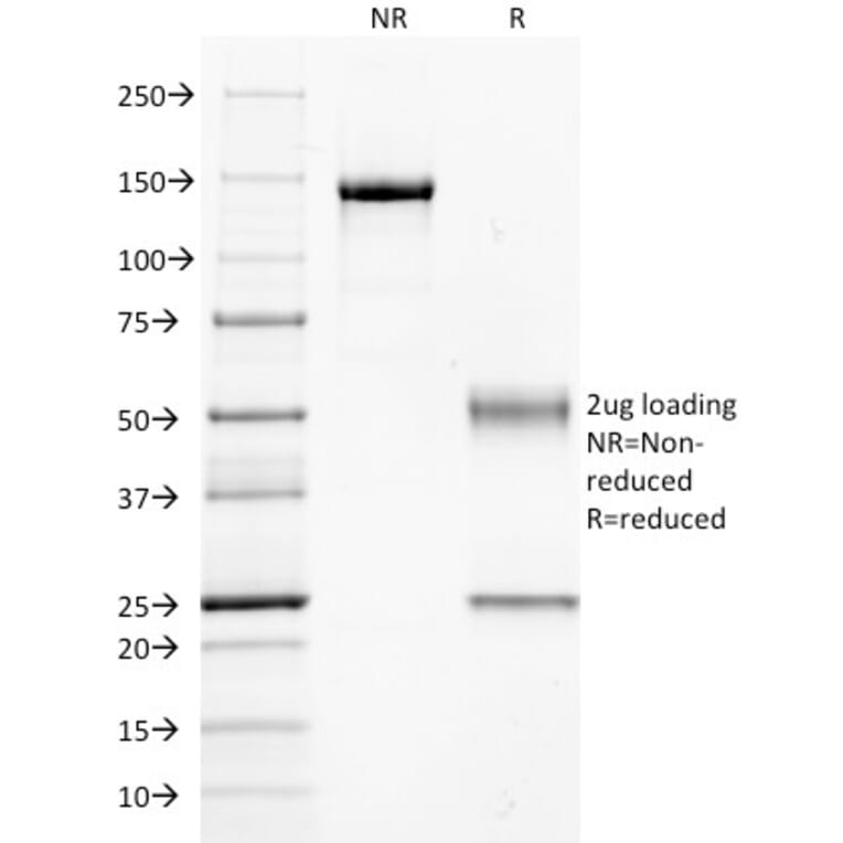 SDS-PAGE - Anti-CD14 Antibody [LPSR/654] (A250577) - Antibodies.com