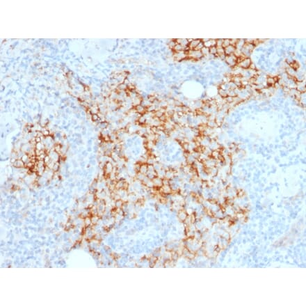 Immunohistochemistry - Anti-CD14 Antibody [LPSR/2385] (A250579) - Antibodies.com