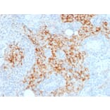 Immunohistochemistry - Anti-CD14 Antibody [LPSR/2385] (A250579) - Antibodies.com