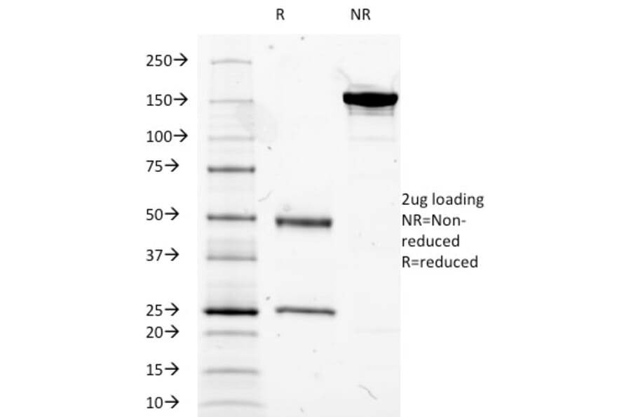 SDS-PAGE - Anti-CD14 Antibody [LPSR/2385] (A250579) - Antibodies.com