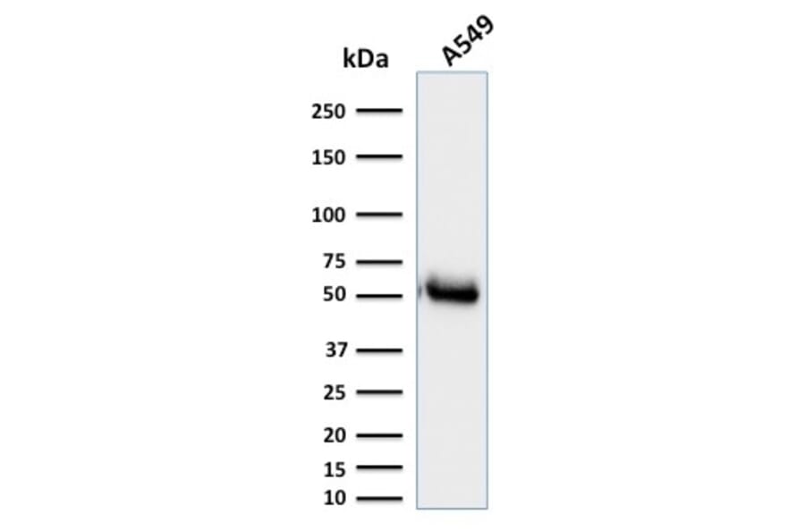 Western Blot - Anti-CD14 Antibody [LPSR/2385] (A250579) - Antibodies.com