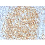 Immunohistochemistry - Anti-CD14 Antibody [LPSR/2386] (A250580) - Antibodies.com
