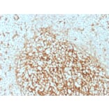 Immunohistochemistry - Anti-CD14 Antibody [LPSR/2386] (A250580) - Antibodies.com
