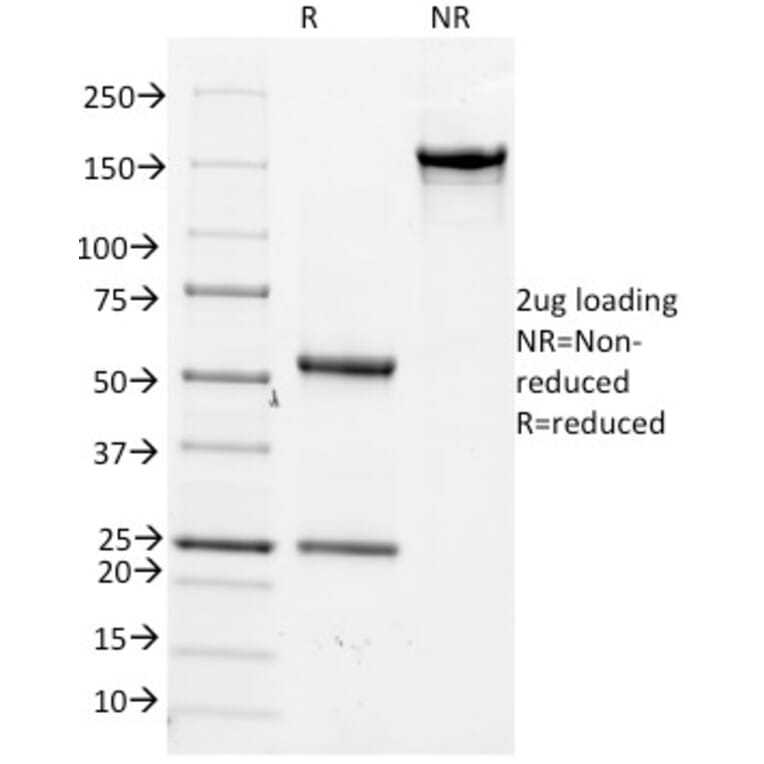 SDS-PAGE - Anti-CD14 Antibody [LPSR/2386] (A250580) - Antibodies.com