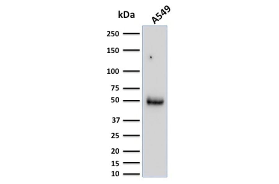 Western Blot - Anti-CD14 Antibody [LPSR/2386] (A250580) - Antibodies.com