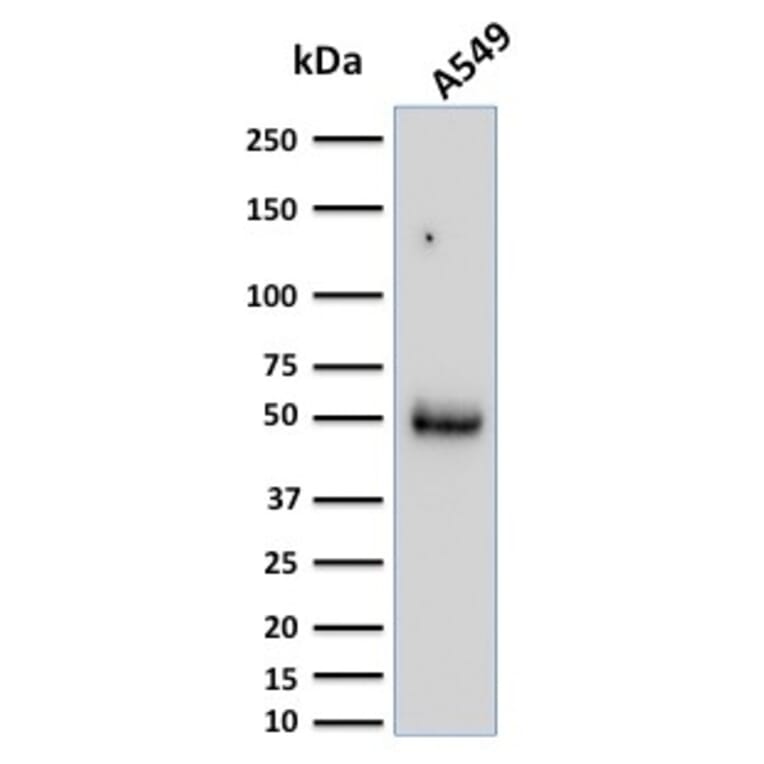 Western Blot - Anti-CD14 Antibody [LPSR/2386] (A250580) - Antibodies.com