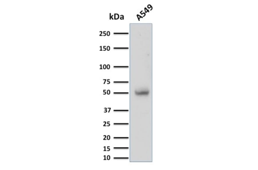 Western Blot - Anti-CD14 Antibody [LPSR/2397] (A250581) - Antibodies.com