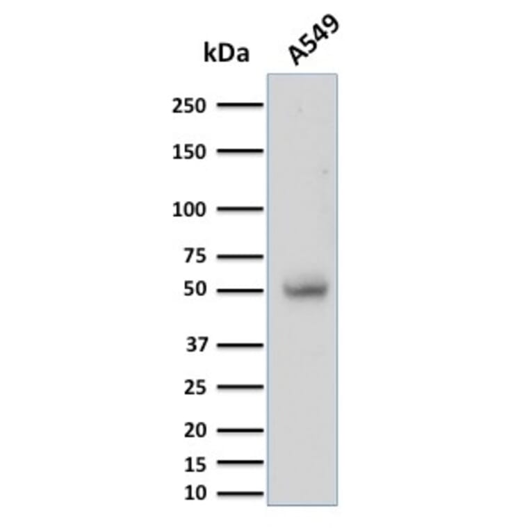 Western Blot - Anti-CD14 Antibody [LPSR/2397] (A250581) - Antibodies.com