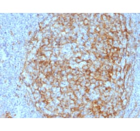 Immunohistochemistry - Anti-CD14 Antibody [LPSR/2408] (A250582) - Antibodies.com