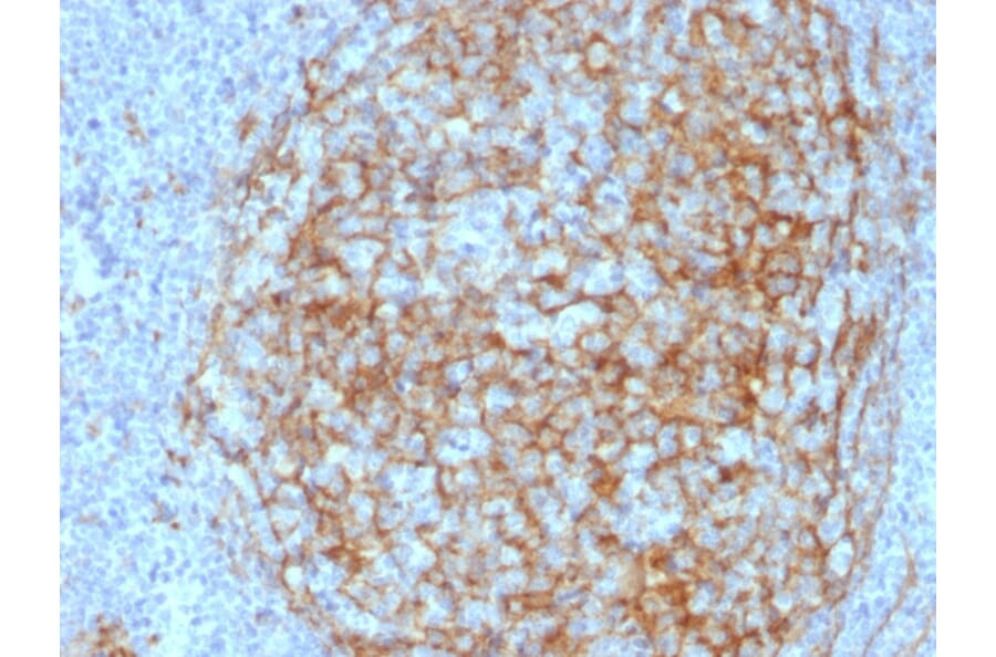 Immunohistochemistry - Anti-CD14 Antibody [LPSR/2408] (A250582) - Antibodies.com