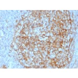 Immunohistochemistry - Anti-CD14 Antibody [LPSR/2408] (A250582) - Antibodies.com