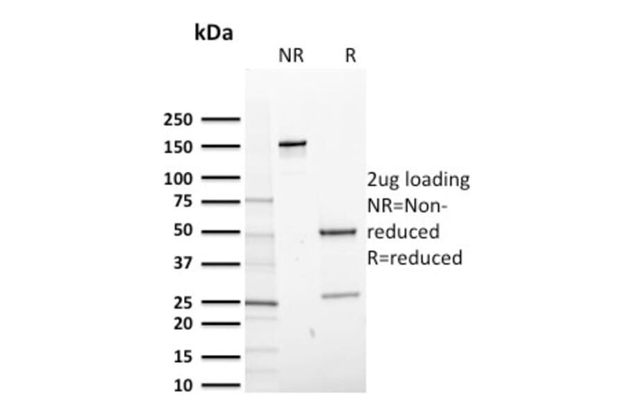 SDS-PAGE - Anti-CD14 Antibody [LPSR/2408] (A250582) - Antibodies.com