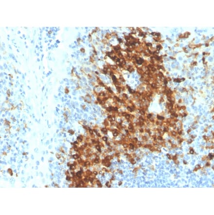 Immunohistochemistry - Anti-CD14 Antibody [LPSR/4180R] (A250583) - Antibodies.com