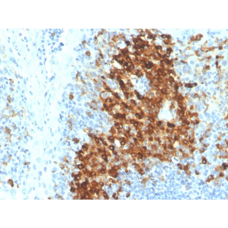 Immunohistochemistry - Anti-CD14 Antibody [LPSR/4180R] (A250583) - Antibodies.com