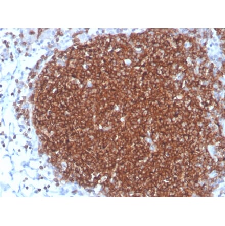 Immunohistochemistry - Anti-CD19 Antibody [rCD19/4591] (A250584) - Antibodies.com
