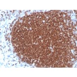 Immunohistochemistry - Anti-CD19 Antibody [rCD19/4591] (A250584) - Antibodies.com